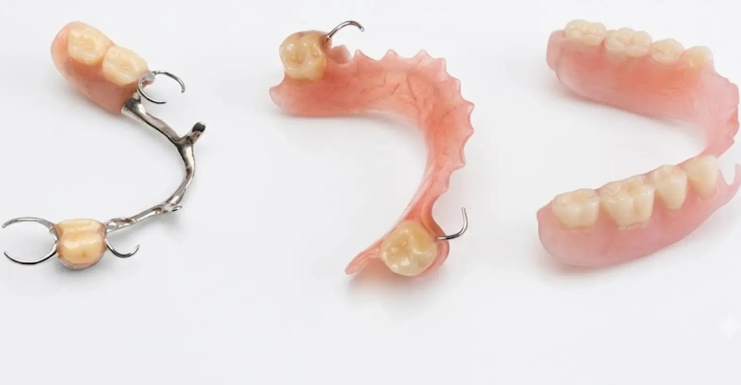 Types of Partial Dentures and Clasp Retained Denture